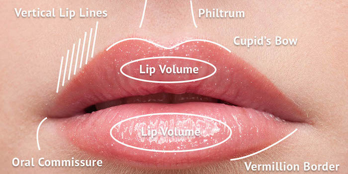 Увеличение и лифтинг губ – обзор хирургических методов