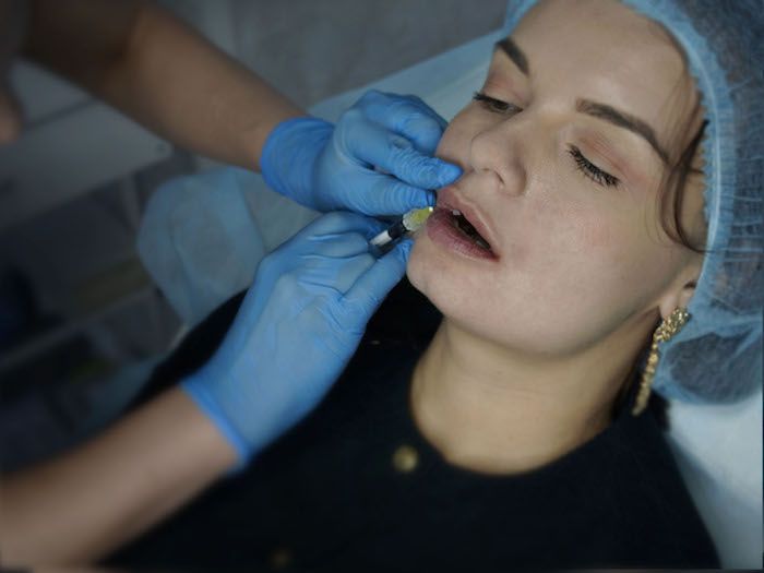 инъекции филлера в губы